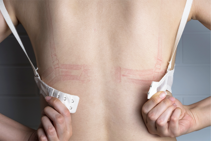 Ill fitting bra sales